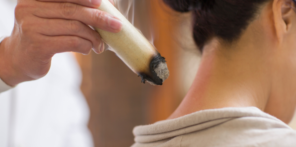 Terapia de moxibustión en el cuello de una persona, utilizada en la medicina tradicional china